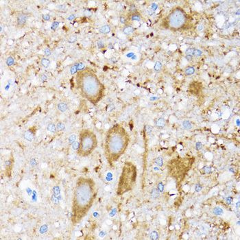 Immunohistochemistry - HSPH1 antibody (144-06622)