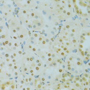 Immunohistochemistry - RCC1 Polyclonal Antibody (144-06350)