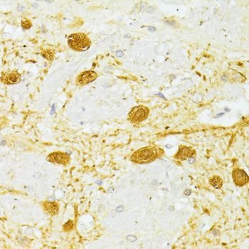 Immunohistochemistry - PVALB antibody (144-60383)