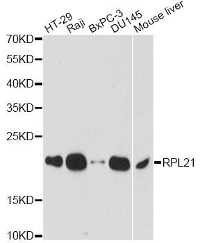 Western blot - RPL21 antibody (144-014254)
