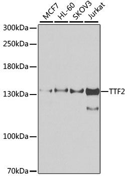 Western blot - TTF2 antibody (144-07751)