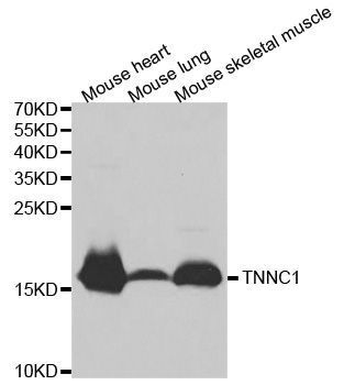 Western blot - TNNC1 antibody (144-01927)