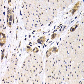 Immunohistochemistry - ATF2 Polyclonal Antibody (144-02155)