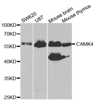 Western blot - CAMK4 Polyclonal Antibody (144-05304)