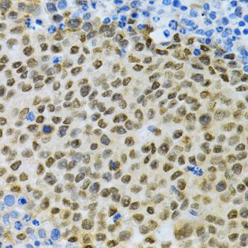 Immunohistochemistry - ELAVL1 Polyclonal Antibody (144-01608)