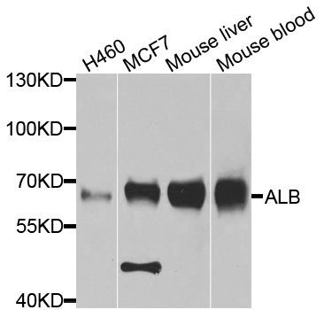Western blot - ALB Polyclonal Antibody (144-00353)