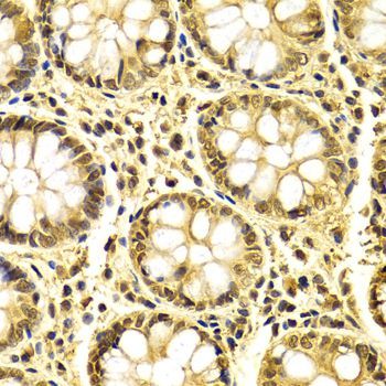 Immunohistochemistry - XRCC3 antibody (144-02134)