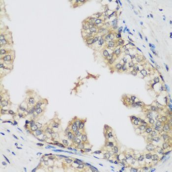 Western blot - RRM1 Polyclonal Antibody (144-01152)