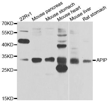 Western blot - APIP antibody (144-07102)