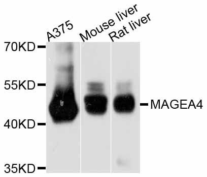 Western blot - MAGEA4 antibody (144-011607)