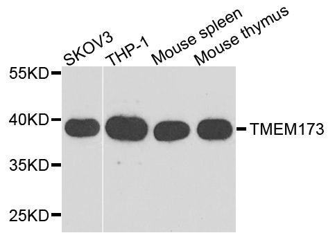 Western blot - TMEM173 Polyclonal Antibody (144-03575)