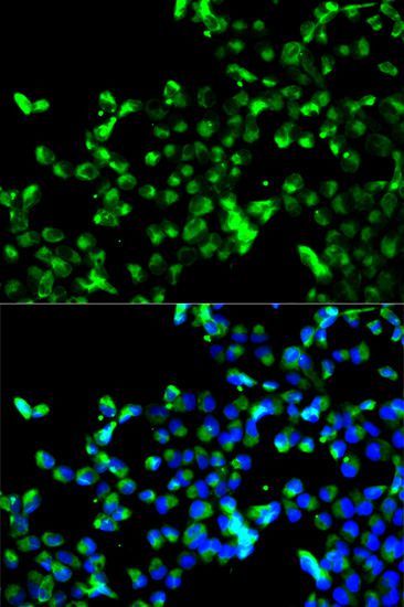 Immunofluorescence - CALR Polyclonal Antibody (144-01066)