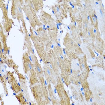 Immunohistochemistry - CCM2 antibody (144-06544)