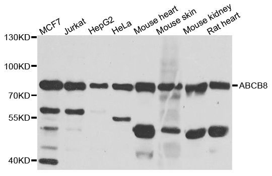 Western blot - ABCB8 antibody (144-02653)