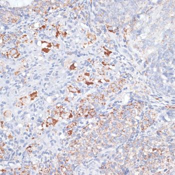 Immunohistochemistry - SMPD1 antibody (144-06743)