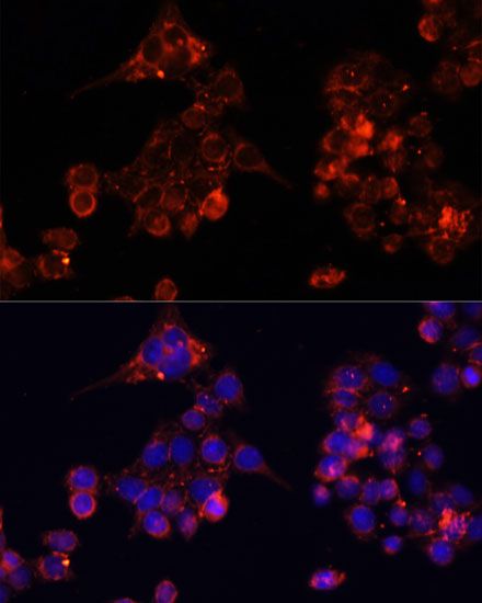 Immunofluorescence - B4GALT4 antibody (144-60752)