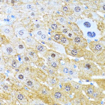 Immunohistochemistry - CCND1 Polyclonal Antibody (144-11022)