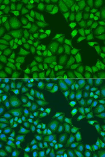Immunofluorescence - TNRC6A antibody (144-06115)