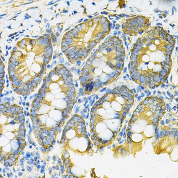 Immunohistochemistry - HSP90AB1 Antibody (144-01087)