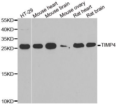Western blot - TIMP4 antibody (144-06416)