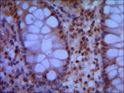 IHC