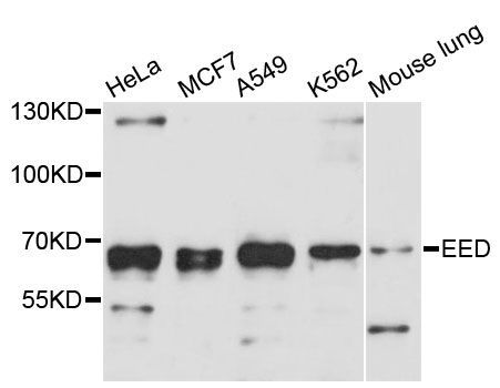 Western blot - EED antibody (144-12773)