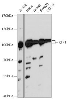 Western blot