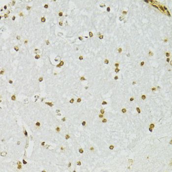 Immunohistochemistry - ADAR Polyclonal Antibody (144-07869)