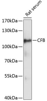 Western blot