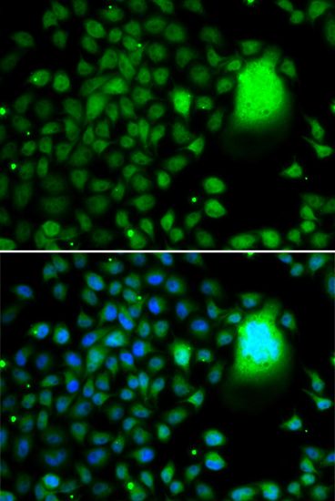 Immunofluorescence - TAF5 Polyclonal Antibody (144-07221)