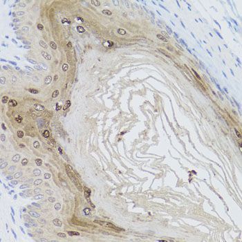 Immunohistochemistry - FLJ20294 Polyclonal Antibody (144-01083)