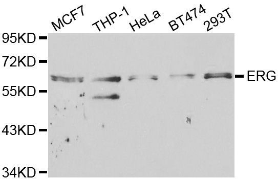 Western blot - ERG antibody (144-01240)