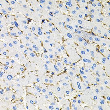 Immunohistochemistry - SSTR2 antibody (144-03135)