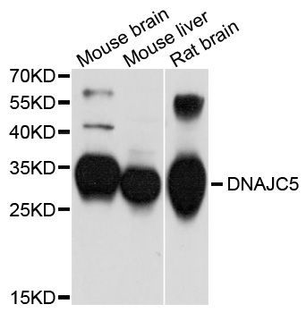 Western blot - DNAJC5 Polyclonal Antibody (144-600559)