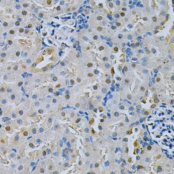 Immunohistochemistry - SPHK1 Polyclonal Antibody (144-00139)