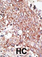 IHC-P