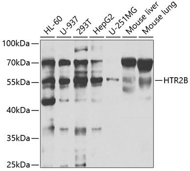 Western blot