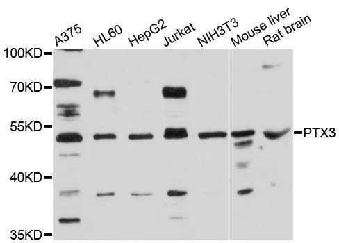 Western blot - PTX3 antibody (144-012669)