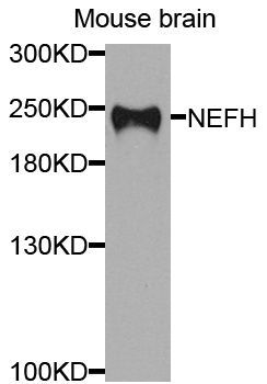 Western blot - NEFH antibody (144-08442)