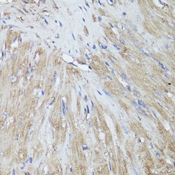 Immunohistochemistry - FOS Polyclonal Antibody (144-00236)