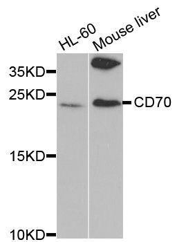 Western blot - CD70 antibody (144-02032)