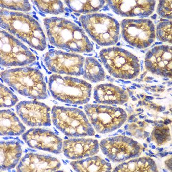 Immunohistochemistry - BMPR1B Polyclonal Antibody (144-02005)