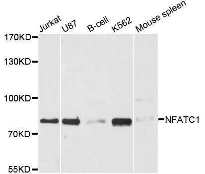 Western blot - NFATC1 Polyclonal Antibody (144-01539)