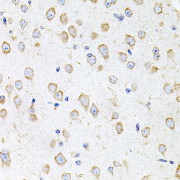 Immunohistochemistry - PROK2 antibody (144-06705)