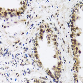 Immunohistochemistry - SAFB2 antibody (144-04330)