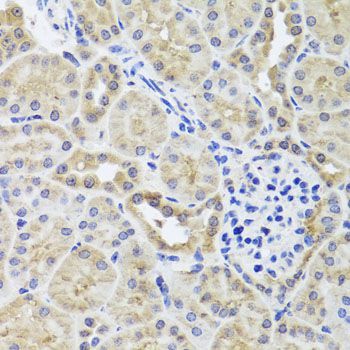 Immunohistochemistry - CGB7 antibody (144-08522)