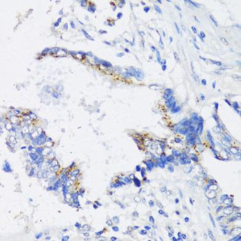 Immunohistochemistry - IKBKE Polyclonal Antibody (144-00244)