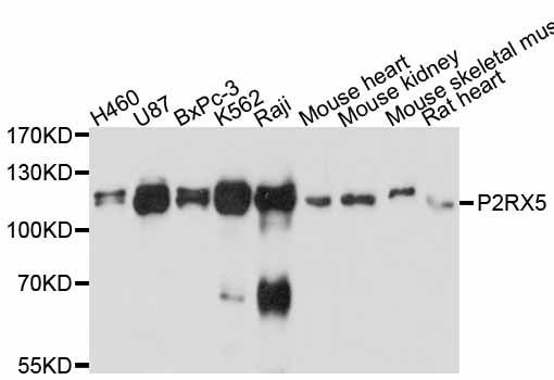 Western blot - P2RX5 antibody (144-011710)