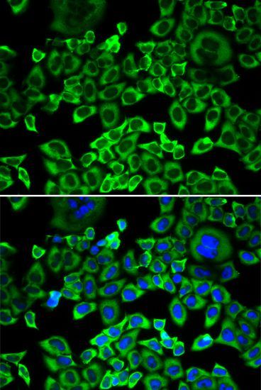 Immunofluorescence - EIF4B Polyclonal Antibody (144-05405)