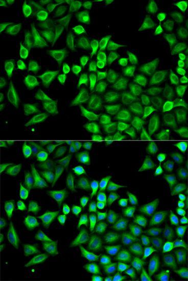 Immunofluorescence - ABAT antibody (144-05299)